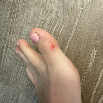 Corner Nails Lounge & Spa - Skin sheer from callus removal - Nail Salons Near Me - San Diego, California