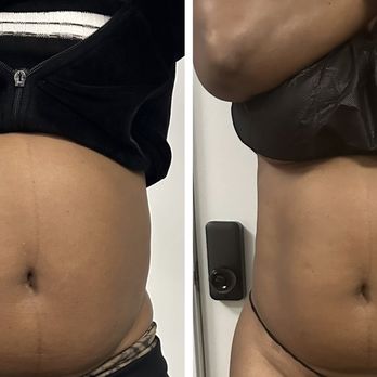 Reje Aesthetics - Body contouring - Skin Care Near Me - North Reading , Massachusetts Reje Aesthetics - Body contouring - Skin Care Near Me - North Reading , Massachusetts