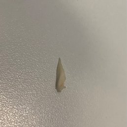 This was in my turkey sandwich!!
