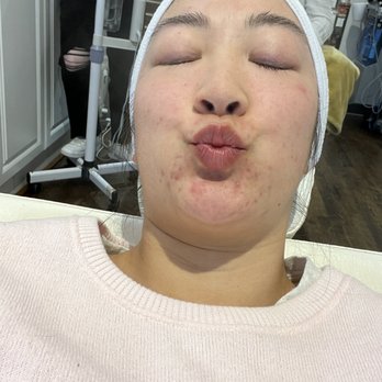 Oasis Face Bar- Lincoln Park - Facial - Skin Care Near Me - Chicago, Illinois