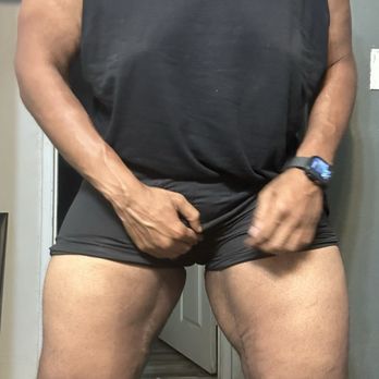 David Liland MD - Significant loose skin post op - poorly done surgery, by a mediocre surgeon - clear uneven contour - Cosmetic Surgeons Near Me - Dallas, Texas