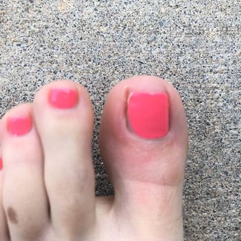 Vip Nail Salon - Infected nail. Day 3 - Nail Salons Near Me - Wichita, Kansas Vip Nail Salon - Infected nail. Day 3 - Nail Salons Near Me - Wichita, Kansas