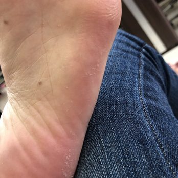 Uptown Nail Salon - sorry to post my dirty feet but this is what i left with. - Nail Salons Near Me - San Diego, California Uptown Nail Salon - sorry to post my dirty feet but this is what i left with. - Nail Salons Near Me - San Diego, California