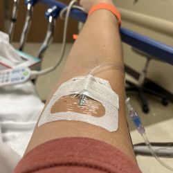 Nebraska Medicine - So happy. I asked them to use an ultrasound because I am very hard to get an IV in to and I feel they always listen.