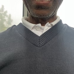 A Brilliant Smile - My dental work.