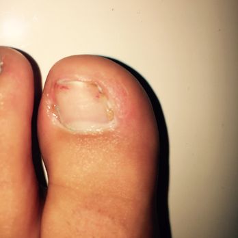 Fancy Nails - 3 days later and I can barely put any pressure due to how deep the cuts are on both sides. It's a nail salon not a treatment for nail cuts - Nail Salons Near Me - Santa Barbara, California