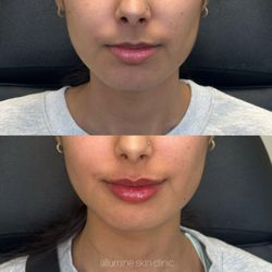 Allumine Skin Clinic