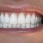 Photo of Healthy Teeth Dental