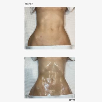 Truly Snatched Body Contouring - Traveling season is approaching make sure your body is at its best! - Body Contouring Near Me - Pasadena, California