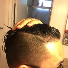 The side of the undercut.