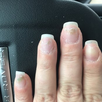 Luxor Nails Spa - See review regarding nail fungus - Nail Salons Near Me - Pittsburgh, Pennsylvania Luxor Nails Spa - See review regarding nail fungus - Nail Salons Near Me - Pittsburgh, Pennsylvania
