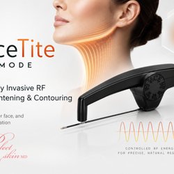 Perfect Skin, MD - Quantum RF Skin Tightening