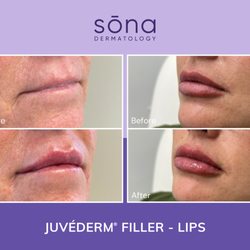 Sona MedSpa