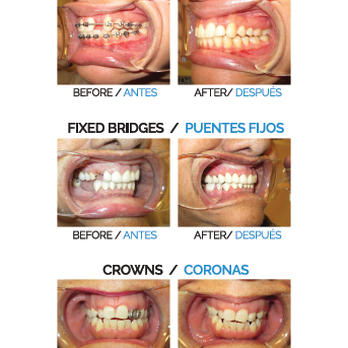 Precision Dental Care - General Dentistry Near Me - Chicago, Illinois Precision Dental Care - General Dentistry Near Me - Chicago, Illinois