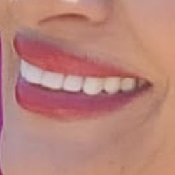 Carmen Ohanian, DDS - Here are my teeth that Dr Ohanian veneered