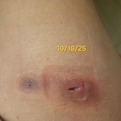 Georgia Skin & Cancer Cllinic