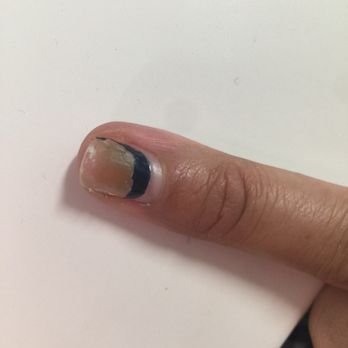 C T Nails - Broke a nail today to find this color on my natural nail. Started to remove the rest and my other nails are turning green - Nail Salons Near Me - Ogden, Utah