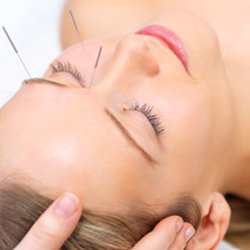 Robert J. Friedman, MD - Acupuncture is a method of encouraging the body to promote natural healing and to improve functioning.