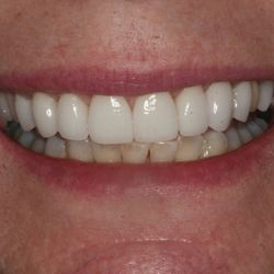 The Dental Design Center - Cosmetic, Implant & General Dentistry