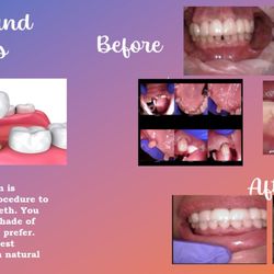 NOVA Dental Center - Restore your smile