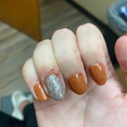 Espres Nails and Spa - infected finger