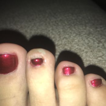 White Lotus Salon - Small callus they wouldn't try filing off ugh - Nail Salons Near Me - Seattle, Washington White Lotus Salon - Small callus they wouldn't try filing off ugh - Nail Salons Near Me - Seattle, Washington