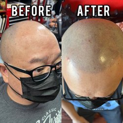 G - Before and After. Done in 3 sessions.