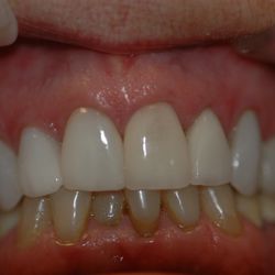 Guy Henry DDS, MS - Before