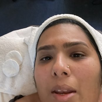 K Skin - During facial - Skin Care Near Me - Carmel, Indiana