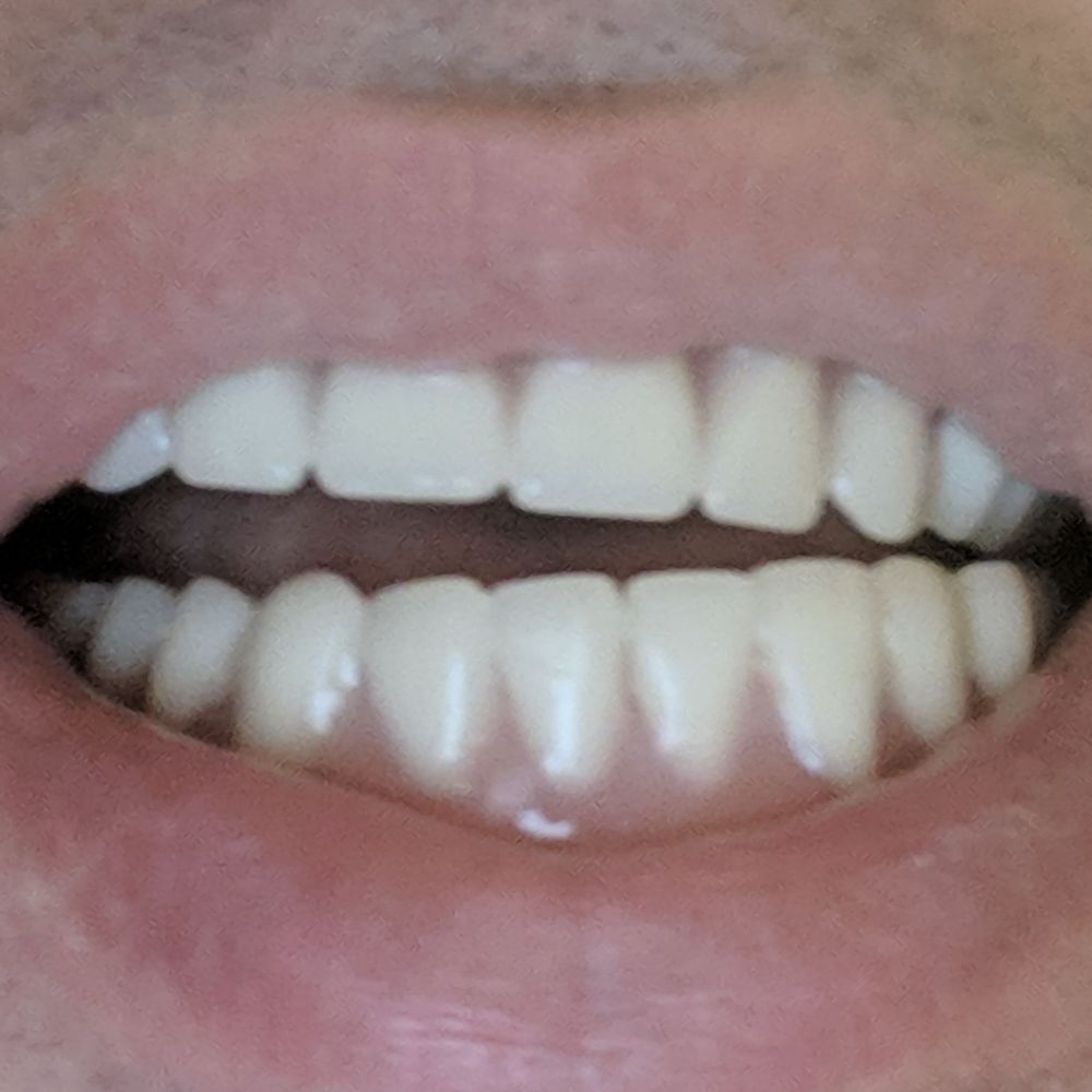 Aspen Dental - Mattoon, IL - Oral Surgeons Near Me - Mattoon, Illinois