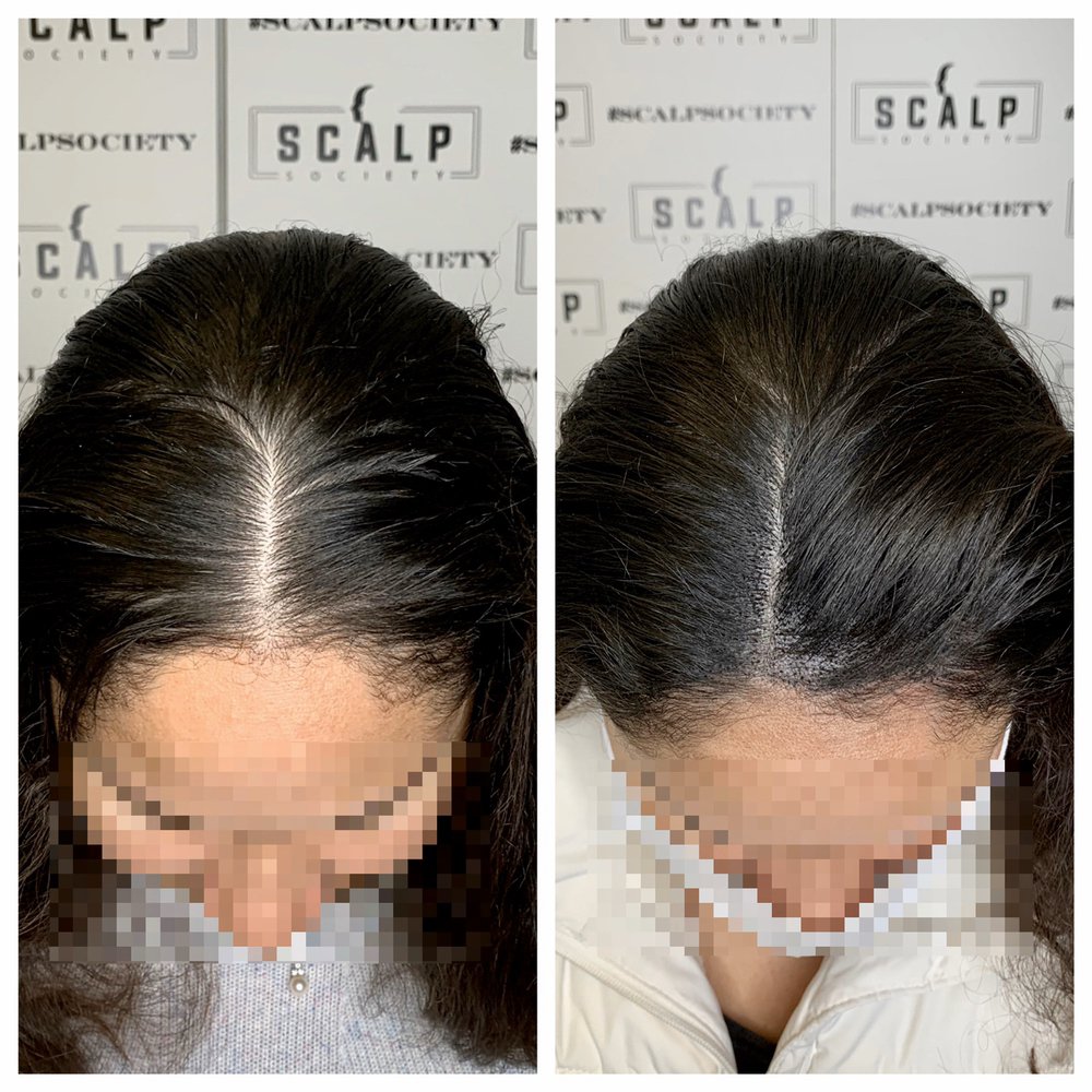 SCALP SOCIETY Request an Appointment 27 Photos & 19 Reviews 1512