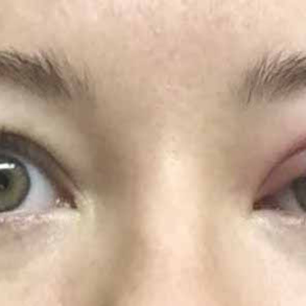 After first night stay at Motel 6 I woke up with a swollen eye from a spider bite. It is a first and last time I am staying in Motel 6.