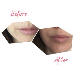 Hospitality Skin Spa & Aesthetics - Jamie did an amazing job with my laser treatment.