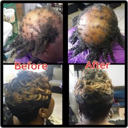 Hair & Beauty Treatment Center - Non Surgical Hair Replacement