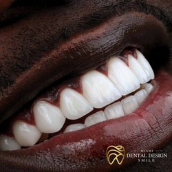 Dental Design Smile Miami