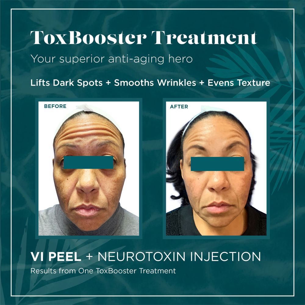 Mobile Botox OC Logo