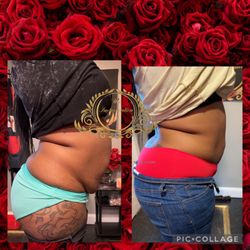 Design By His Imagination - Two sessions Lipo Cavitation with RS