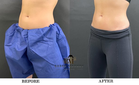 Bared Monkey Laser Spa by null