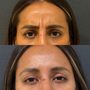 Photo of Renew Laser & Aesthetic Medicine