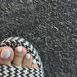 Baressito Antro Bar - Broken toe nail