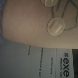 Exer Urgent Care - Two stab wounds