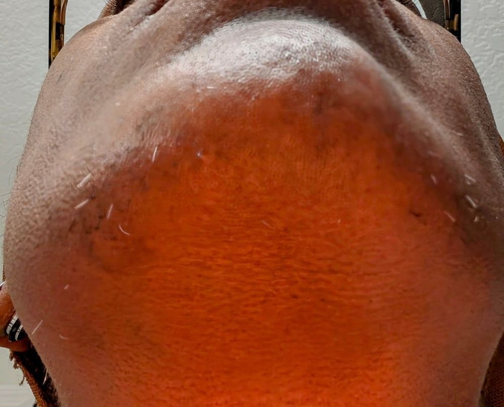 Electrolysis by Debra Logo