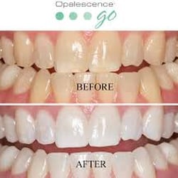 Saybrook Family Dental Care David Sliva DMD - Stop in today to pick up the BEST new whitening product. Now $75.00 per box of 10!