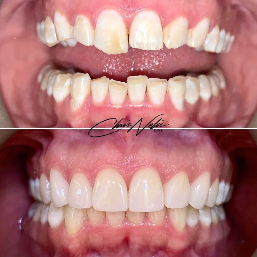 CHRISTOPHER NELIS, DDS Updated August 2024 187 Riley St, Holland