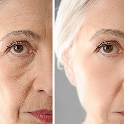Results Weight Loss & Med Spa - Botox Treatment