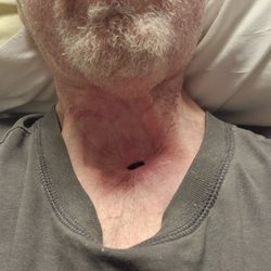 Regions Hospital Breast Health Center - The pain Dr.s at Regions are incompetent.