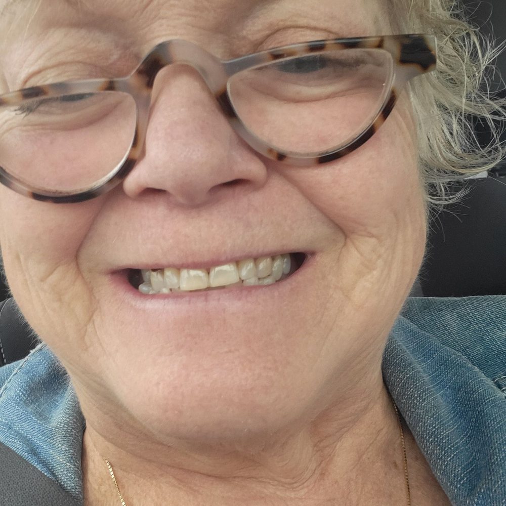 no cavities except incisor.