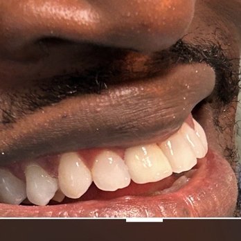 JG Dental - General Dentistry Near Me - San Juan Capistrano, California JG Dental - General Dentistry Near Me - San Juan Capistrano, California