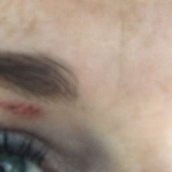 Regis Salon - The burns on my friends eyebrows from the wax