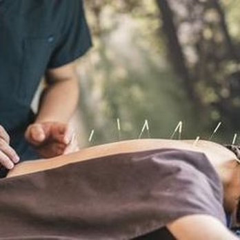 Avicenna Acupuncture - What to Expect on Your First Visit to an Acupuncturist - Acupuncture Near Me - Wheat Ridge, Colorado